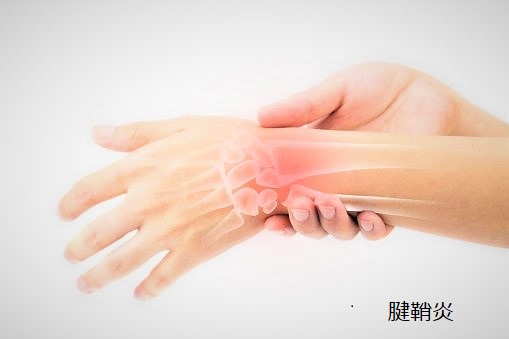 腱鞘炎、バネ指について