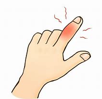 軽く見がちな突き指について